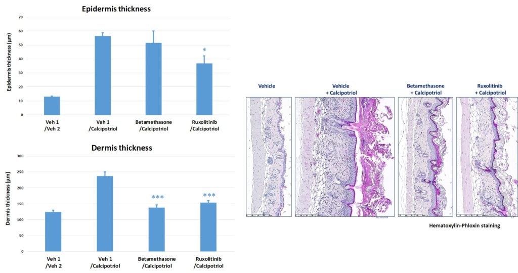 Dermal - calcipotriol atopic dermatitis histology results