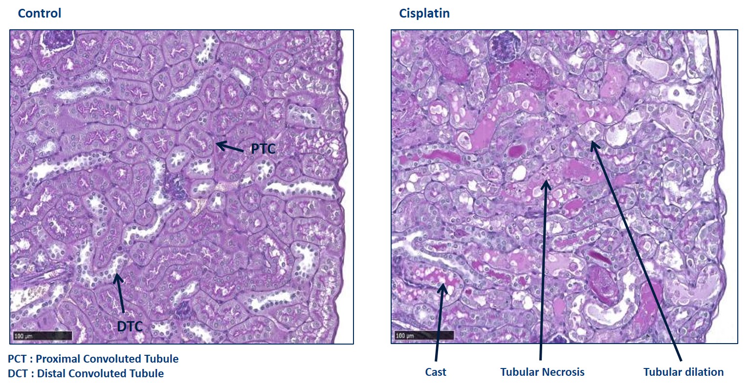 Kidney - Cisplatin kidney injury model necrosis histology.png