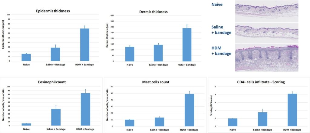 Atopic dermatitis models | Oncodesign Services