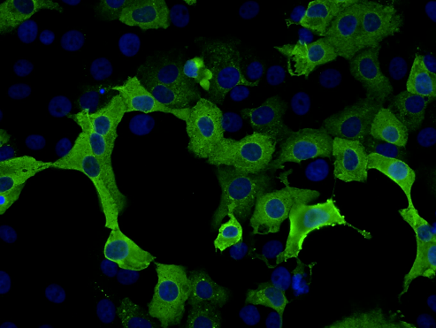 Vero E6/TMPRSS2 cell infected with SARS-Cov2 (strain SK-BMC5/2020). Nucleoprotein / NP Antibody (nucleocapsid protein- green) immunofluorescence vs. nucleus staining (blue)