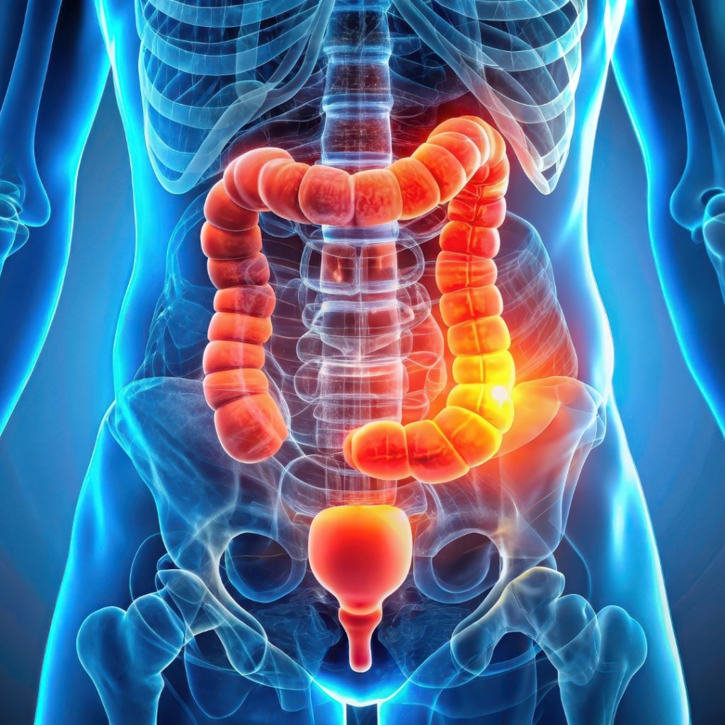 A graphic representation of the human body in x-ray, with the gastrointestinal system highlighted.
