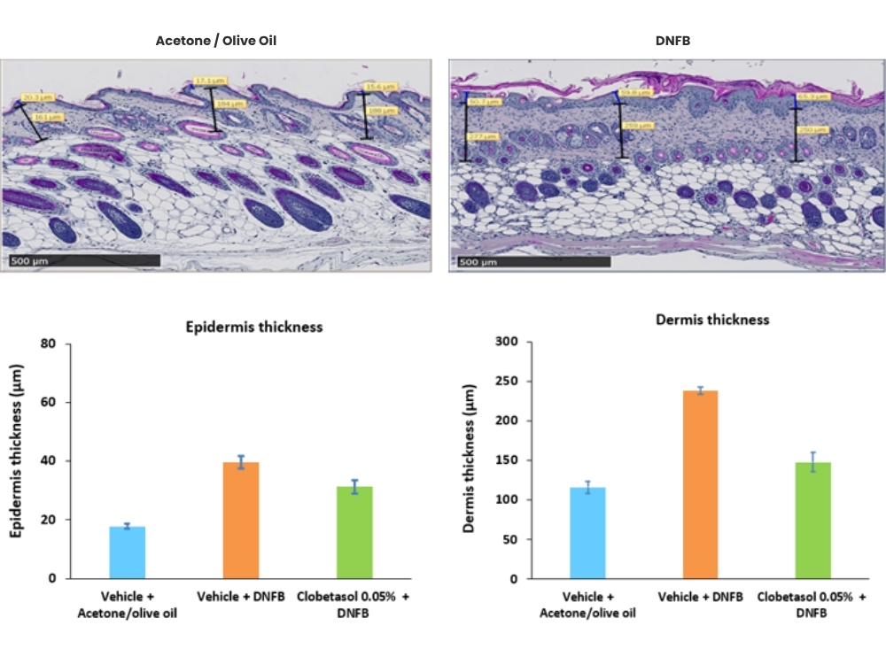 H&E stained slides of skin samples obtained in DNFB model of skin allergy, with associated measurements of skin layer thickness.