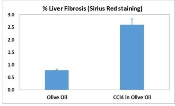 CCl4 liver fibrosis biomarker results 