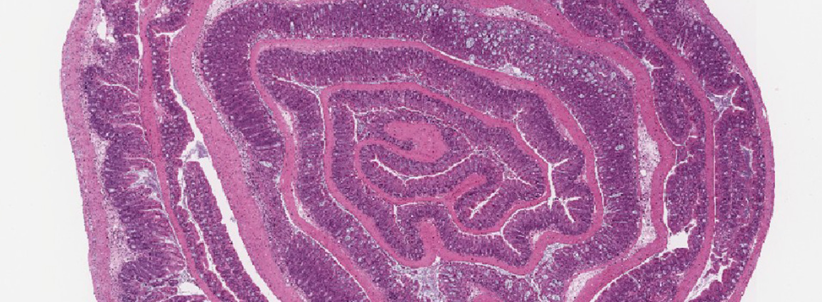 IBD Histology DSS H&E Stain Colon