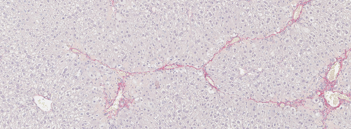 Liver fibrosis with a sirius red stain in a CCl4 model on D42