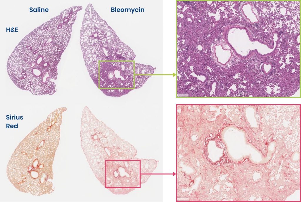 Lung fibrosis histology showing bleomycin challenge vs control