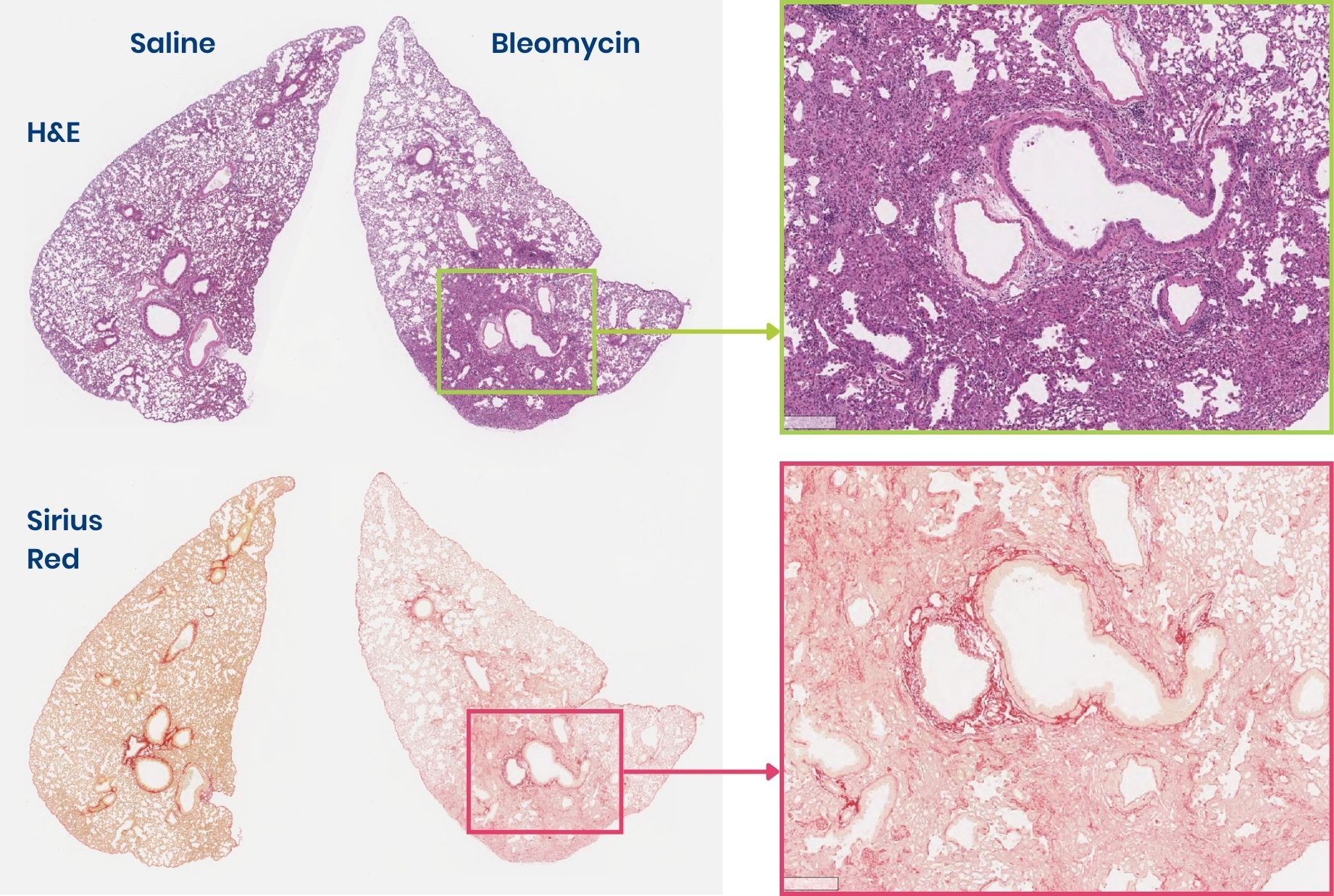 Lung fibrosis histology showing bleomycin challenge vs control
