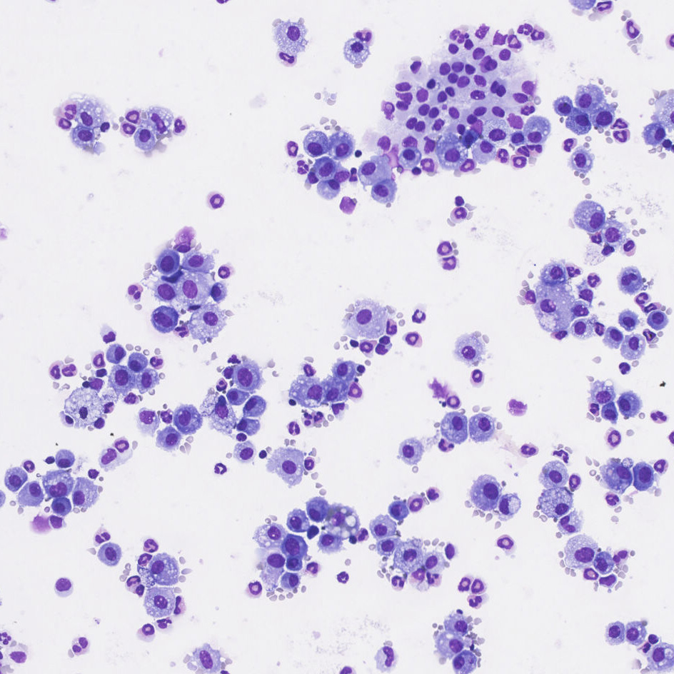 BAL cells in an OVA model of asthma (MGG stain)