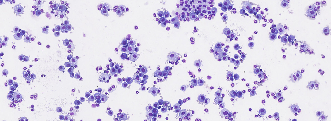 MGG stain – BAL cells – OVA model of asthma