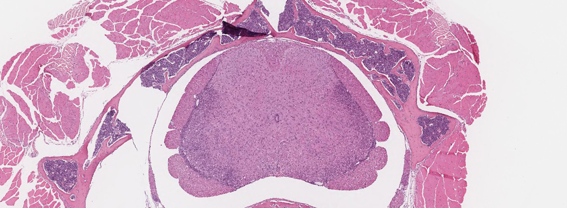 MOG induced spine pathology image with H&E stain