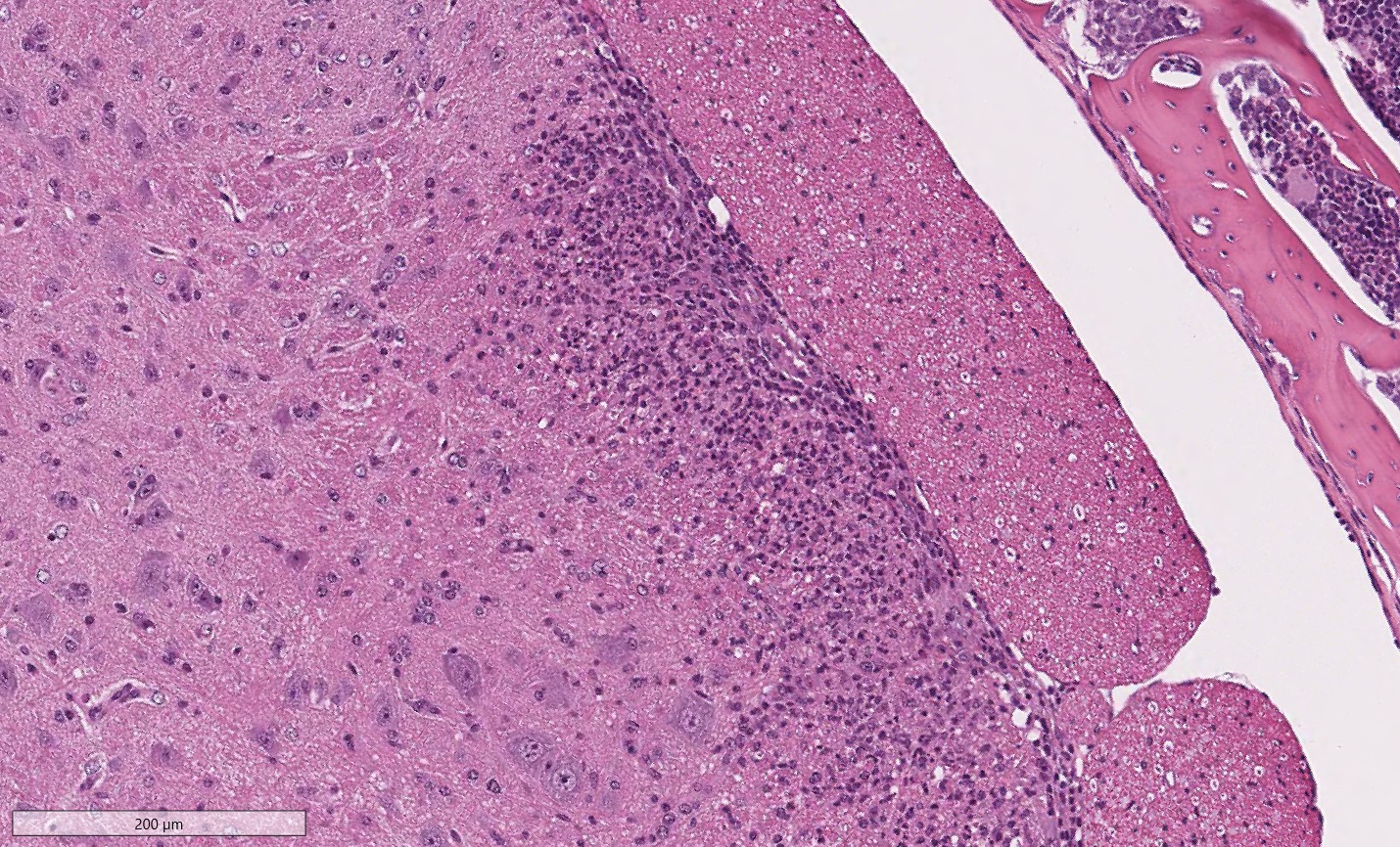 Zoomed view of MOG-induced spine pathology image with H&E stain