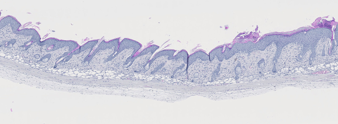 Psoriasis model dermal sample following Imiquimod application (day 8)