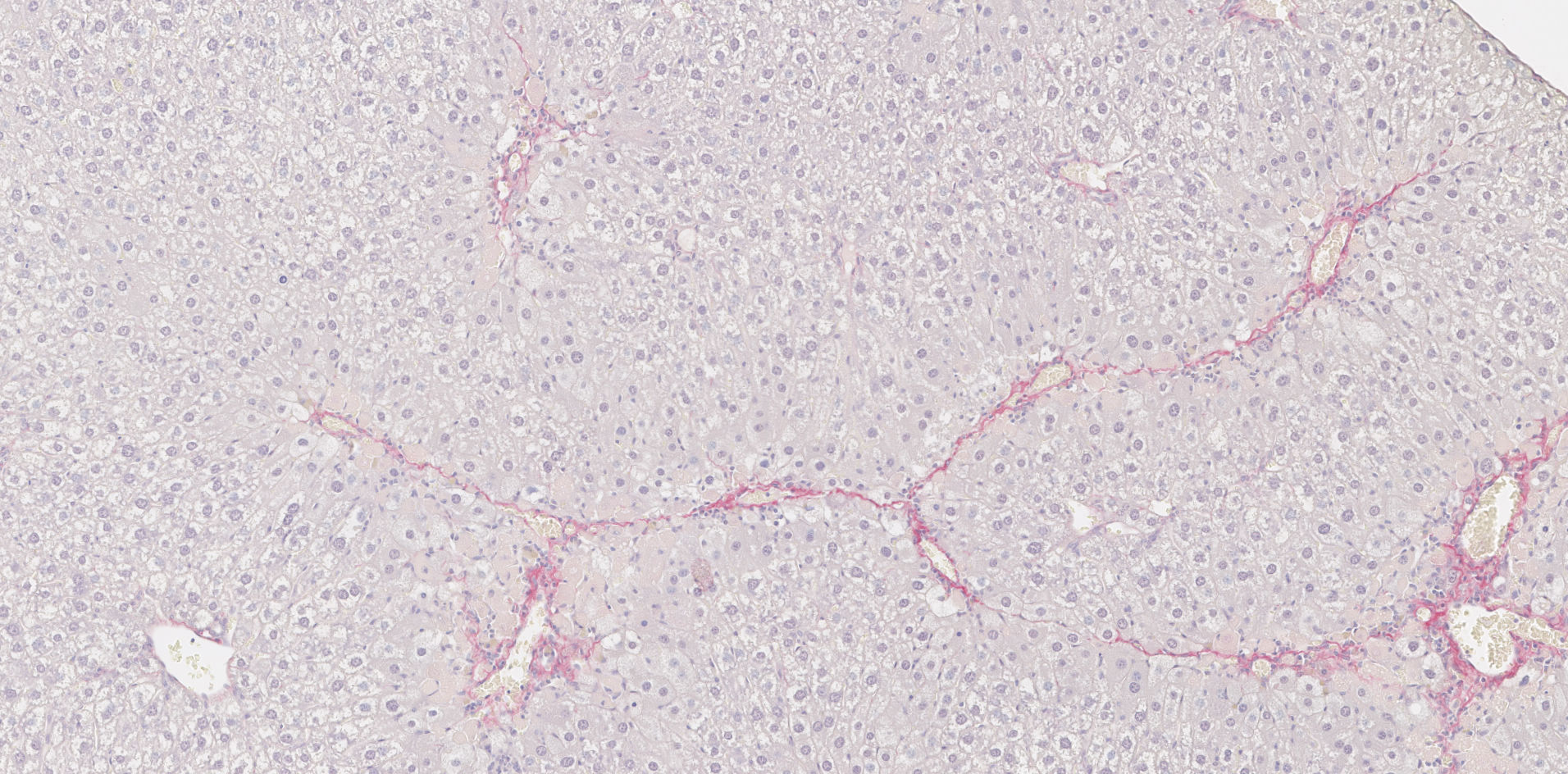 Liver fibrosis in a CCl4 model (D42). Sirius red stain.