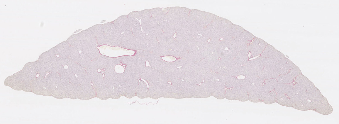 Liver fibrosis model in a ccl4 model with a sirius red stain