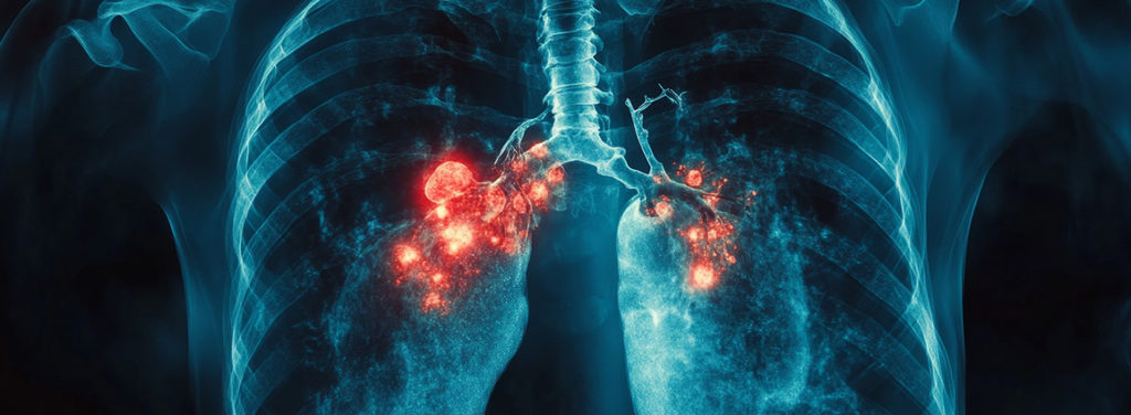 Assessing Functional Efficacy in Preclinical Pulmonary Fibrosis Models